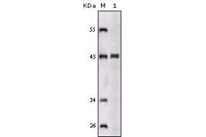 Western blot analysis using SORL1 mouse mAb against truncated SORL1 recombinant protein. (SORL1 抗体)