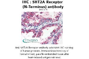 Image no. 1 for anti-5-Hydroxytryptamine (serotonin) Receptor 2A (HTR2A) (N-Term) antibody (ABIN1731362)
