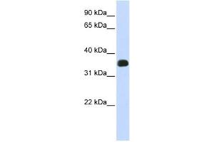 C2ORF47 antibody used at 1 ug/ml to detect target protein. (C2orf47 抗体  (Middle Region))