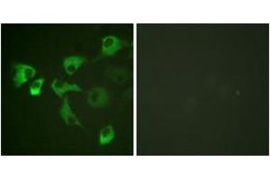 Immunofluorescence analysis of HuvEc cells, using eEF2 (Phospho-Thr56) Antibody. (EEF2 抗体  (pThr56))