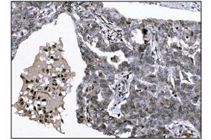 IHC analysis of KMT1B/SUV39H2 using anti-KMT1B/SUV39H2 antibody (ABIN7602135). (SUV39H2 抗体  (AA 6-410))