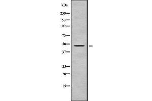 Western blot analysis FOXD4L5 using COLO205 whole cell lysates (FOXD4L5 抗体  (Internal Region))