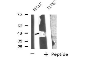 Western blot analysis of extracts from HUVEC cells, using PPP1R7 antibody.