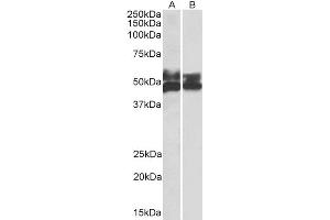 Western Blotting (WB) image for anti-Fc Receptor-Like 1 (FCRL1) antibody (ABIN5900721) (FCRL1 抗体)