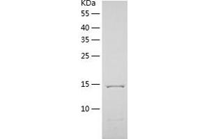 Tetratricopeptide Repeat Domain 32 (TTC32) (AA 1-151) protein (His tag)