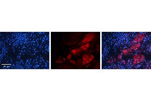 Immunohistochemistry (IHC) image for anti-K(lysine) Acetyltransferase 5 (KAT5) (C-Term) antibody (ABIN2780773)
