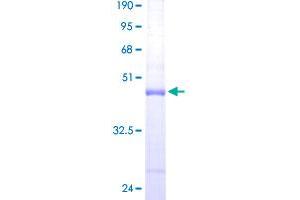 ARPC5 Protein (AA 1-154) (GST tag)