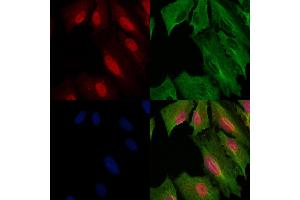 ABIN6259347 and ABIN6275551 staining  cells by IF/ICC. (PPP4R1L 抗体  (C-Term))