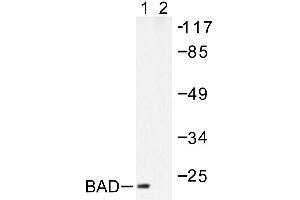 Image no. 1 for anti-BCL2-Associated Agonist of Cell Death (BAD) antibody (ABIN265323) (BAD 抗体)