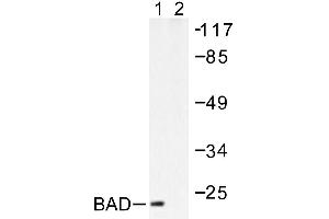 Image no. 1 for anti-BCL2-Associated Agonist of Cell Death (BAD) antibody (ABIN265323)
