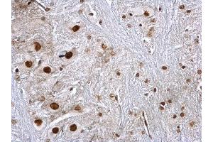 IHC-P Image hnRNP K antibody detects hnRNP K protein at nucleus on rat brain stem by immunohistochemical analysis. (HNRNPK 抗体)