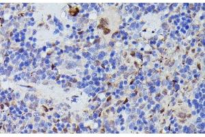 Immunohistochemistry of paraffin-embedded Rat spleen using CDC23 Polyclonal Antibody at dilution of 1:100 (40x lens). (CDC23 抗体)