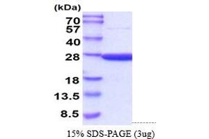 SDS-PAGE (SDS) image for Peroxiredoxin 2 (PRDX2) (AA 1-198) (Active) protein (His tag) (ABIN6388119) (Peroxiredoxin 2 Protein (PRDX2) (AA 1-198) (His tag))