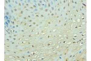 Immunohistochemistry of paraffin-embedded human esophageal tissue using  at dilution of 1: 100 (TEP1 抗体  (AA 2-226))