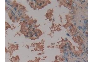 Immunohistochemistry (IHC) image for anti-Serpin Family C Member 1 (SERPINC1) antibody (ABIN7426502)