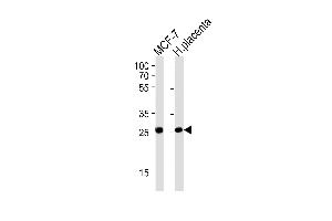 PRLR Antibody (Center) (ABIN1881684 and ABIN2843621) western blot analysis in MCF-7 cell line and human placenta tissue lysates (35 μg/lane). (Prolactin Receptor 抗体  (AA 147-179))