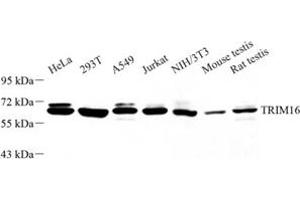 Western blot analysis of TRIM16 (ABIN7076012) at dilution of 1: 1000 (TRIM16 抗体)
