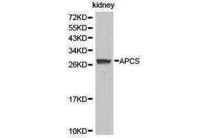 Western Blotting (WB) image for anti-Amyloid P Component, Serum (APCS) antibody (ABIN1871016) (APCS 抗体)