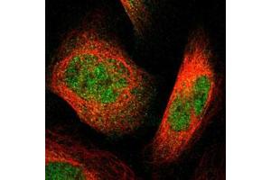 Immunofluorescent staining of human cell line U-2 OS with PLEKHA1 polyclonal antibody  at 1-4 ug/mL shows positivity in nucleus. (PLEKHA1 抗体)