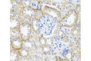 Immunohistochemistry of paraffin-embedded Mouse kidney using ASL Polyclonal Antibody at dilution of 1:100 (40x lens). (ASL 抗体)