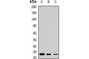 Western blot analysis of MSRB3 expression in mouse testis (A), mouse brain (B), rat lung (C) whole cell lysates. (MSRB3 抗体)