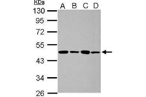 WB Image Sample (30 ug of whole cell lysate) A: 293T B: A431 C: HeLa D: HepG2 10% SDS PAGE antibody diluted at 1:1000 (PPME1 抗体)