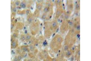 Immunohistochemistry (IHC) image for anti-serine Peptidase Inhibitor, Kazal Type 1 (SPINK1) (AA 26-78) antibody (ABIN7436420)