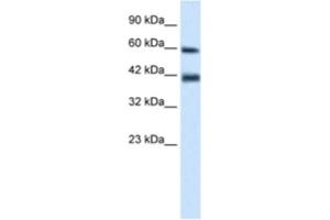Western Blotting (WB) image for anti-Tripartite Motif Containing 31 (TRIM31) antibody (ABIN2461032) (TRIM31 抗体)