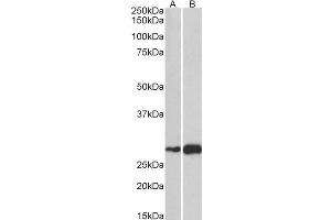 ABIN570906 (1µg/ml) staining of Mouse (A) and Rat (B) Skeletal Muscle lysate (35µg protein in RIPA buffer). (ATF5 抗体  (C-Term))