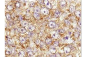 Immunohistochemistry. (AKT1 抗体  (C-Term))