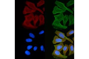 ABIN6255420 and ABIN6268978 staining Hela cells(30 min of UV treatment) by IF/ICC. (LCK 抗体  (pSer59))