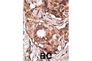 Immunohistochemistry (IHC) image for anti-Melanoma Antigen Family B, 2 (MAGEB2) antibody (ABIN3002533) (MAGEB2 抗体)