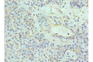 Immunohistochemistry (IHC) image for anti-Neurotrophic tyrosine Kinase, Receptor, Type 3 (NTRK3) (AA 40-300) antibody (ABIN7161741)