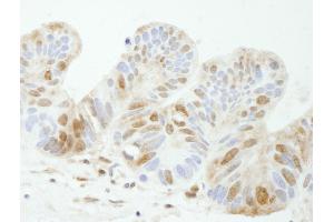 Immunohistochemistry (IHC) image for anti-Tyrosyl-DNA Phosphodiesterase 1 (TDP1) (AA 1-50) antibody (ABIN7448828) (TDP1 抗体  (AA 1-50))