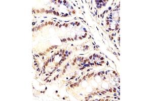 Immunohistochemical analysis of paraffin-embedded M. (CTR9 抗体  (C-Term))