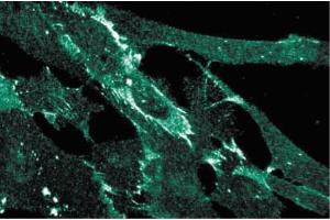 Immunofluorescence staining of human fibroblasts. (HNRNPU 抗体  (AA 326-632))