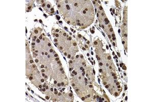 Immunohistochemistry of paraffin-embedded human stomach using GPS1 antibody at dilution of 1:100 (x400 lens). (GPS1 抗体)