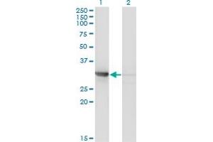 Western Blot analysis of CDK2 expression in transfected 293T cell line by CDK2 monoclonal antibody (M01A), clone 3A2-3G6. (CDK2 抗体  (AA 1-298))