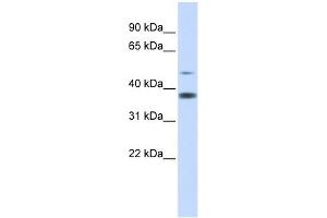 C2ORF25 antibody used at 1 ug/ml to detect target protein. (MMADHC 抗体  (Middle Region))