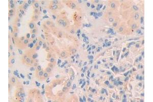 DAB staining on IHC-P; Samples: Human Kidney Tissue (Myosin IC 抗体  (AA 765-1011))