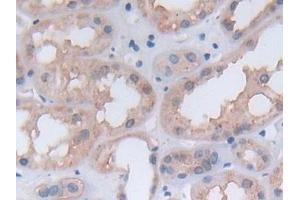 Detection of PGK1 in Human Kidney Tissue using Polyclonal Antibody to Phosphoglycerate Kinase 1 (PGK1) (PGK1 抗体  (AA 2-417))