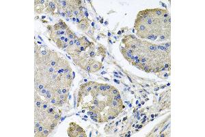 Immunohistochemistry of paraffin-embedded human stomach using NDUFA6 antibody at dilution of 1:100 (x40 lens).