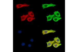 ABIN7095172 and ABIN7099228 staining Hela cells by IF/ICC.