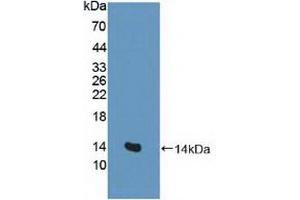 Figure. (SLC1A1 抗体  (AA 115-209))