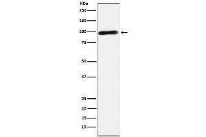 Western blot analysis of Calmegin expression in Jurkat cell lysate. (Recombinant Calmegin 抗体)