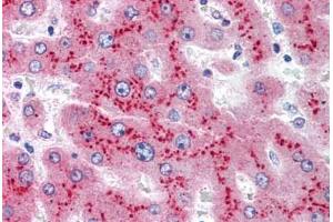 Human Liver (formalin-fixed, paraffin-embedded) stained with SAA1 antibody ABIN305737 at 5 ug/ml followed by biotinylated anti-mouse IgG secondary antibody ABIN481714, alkaline phosphatase-streptavidin and chromogen. (SAA1 抗体)