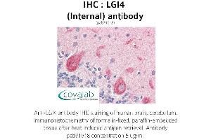 Image no. 1 for anti-Leucine-Rich Repeat LGI Family, Member 4 (LGI4) (Internal Region) antibody (ABIN1736431) (LGI4 抗体  (Internal Region))
