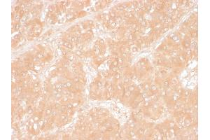 Formalin-fixed, paraffin-embedded human Adrenal stained with Adipophilin Mouse Monoclonal Antibody (ADFP/1366). (ADRP 抗体  (AA 249-376))
