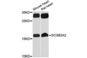 Western blot analysis of extracts of various cell lines, using SCGB3A2 antibody (ABIN6290951) at 1:3000 dilution.