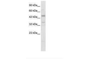 Image no. 1 for anti-Zinc Finger Protein 358 (ZNF358) (AA 104-153) antibody (ABIN202633) (ZNF358 抗体  (AA 104-153))